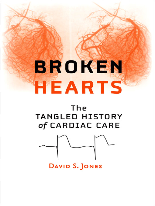 Title details for Broken Hearts by David S. Jones - Available